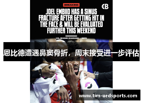 恩比德遭遇鼻窦骨折，周末接受进一步评估